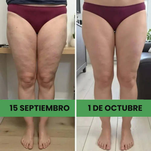 Leggings 3D que moldean y reducen celulitis - [Compra 1 y llévate 2]